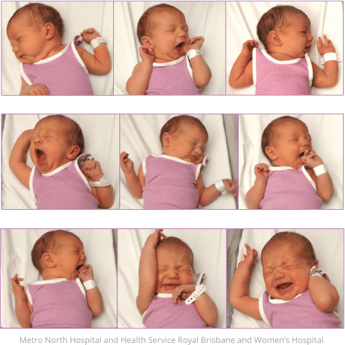 Ces photos montrent les signes qui indiquent qu'un bébé est pret à téter. l'observation et la compréhension de ces signes permet de favorser la prise de poids du bébé allaité car il est alors capable de téter correctement.